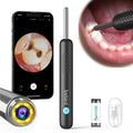 Dental oral camera for kids with phone app showing teeth view