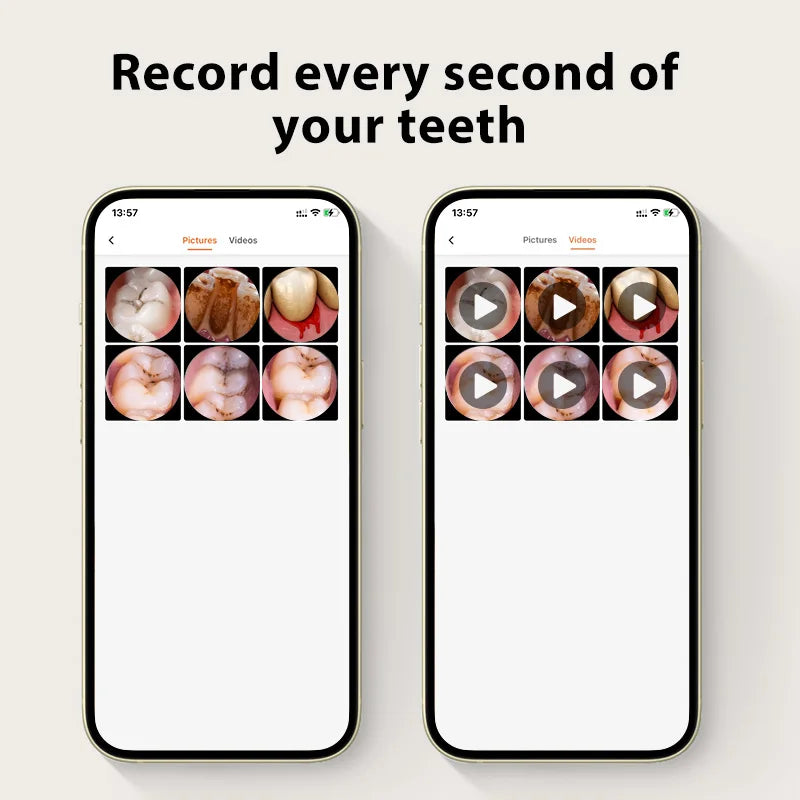Dental oral camera app recording teeth photos and videos