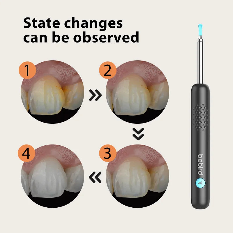 Dental oral camera showing teeth close-up views sequence