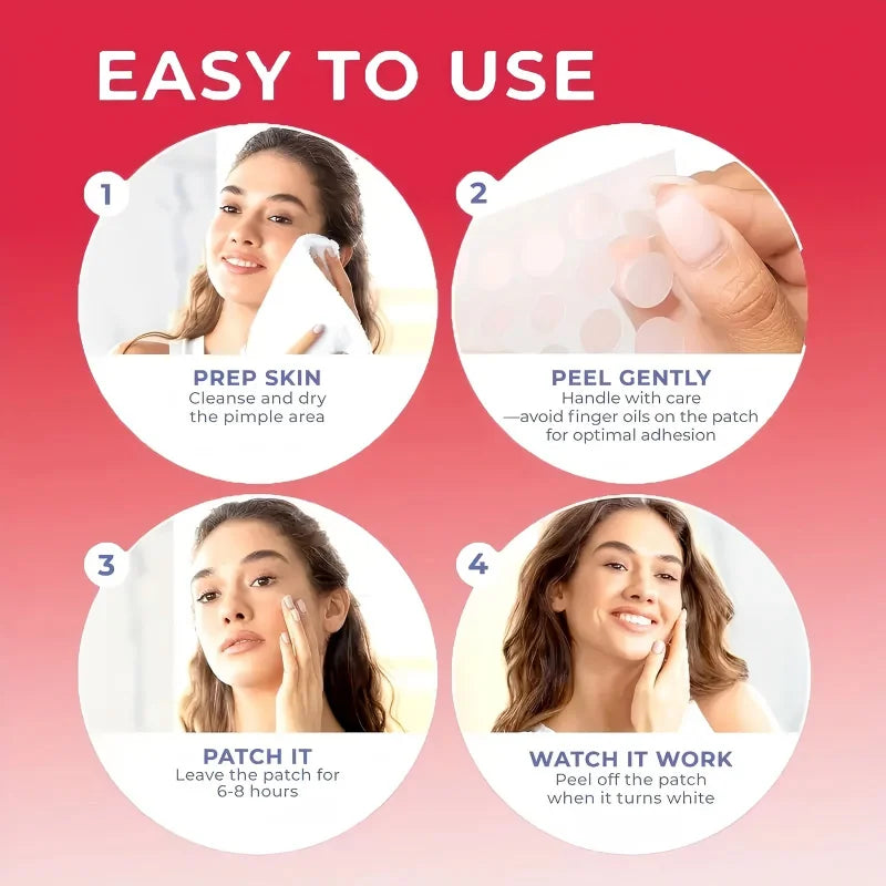 How to use hydrogel acne patches – 4 steps